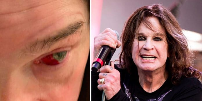 Ozzy Osbourne